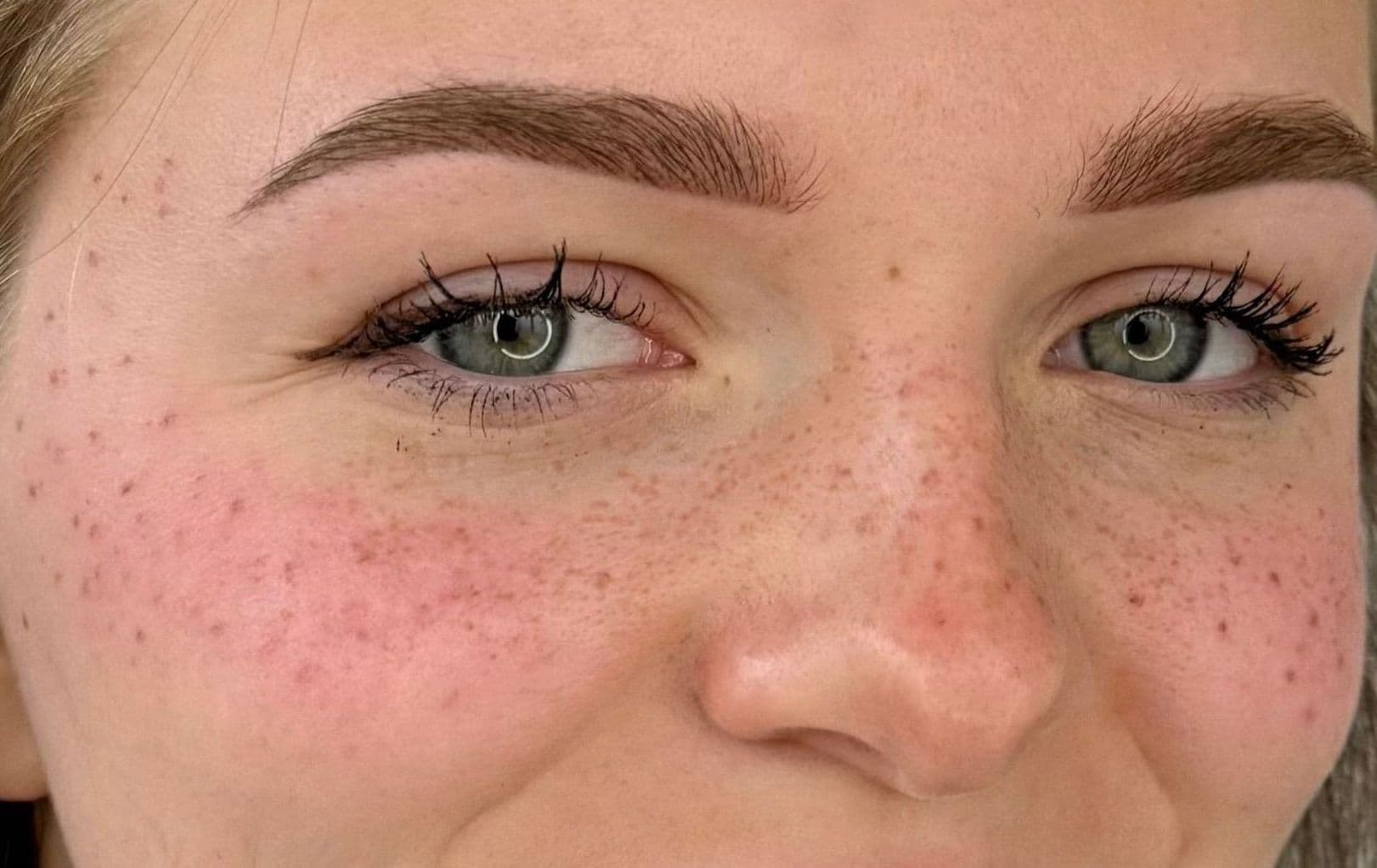 Tatouage des taches de rousseur permanent pour un effet soleil naturel sur peau claire, pigmentation marron clair réalisée par Habiba Med.